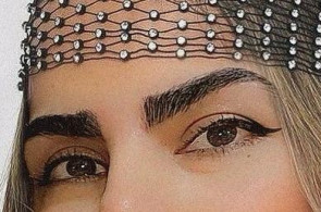 بهترین و پرتراکم ترین مرکز و روش کاشت مو و ابرو در تهران