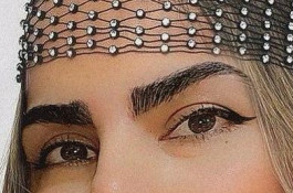 بهترین و پرتراکم ترین مرکز و روش کاشت مو و ابرو در تهران