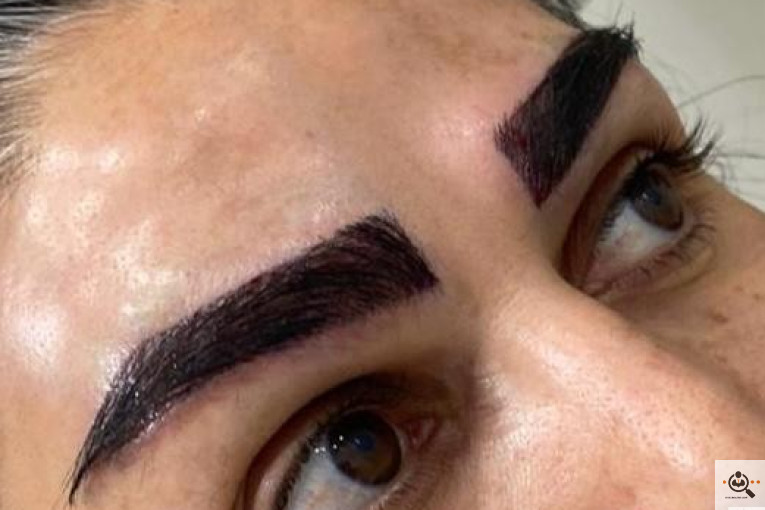 بهترین و پرتراکم ترین مرکز و روش تخصصی کاشت مو و ابرو در تهران