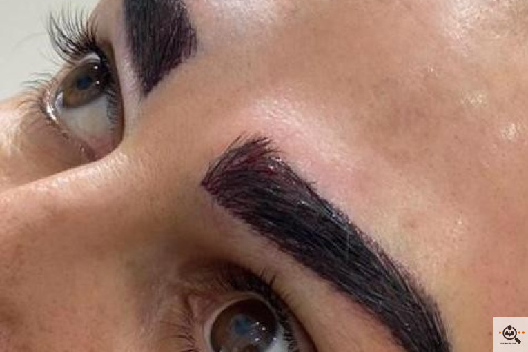 بهترین و پرتراکم ترین مرکز و روش تخصصی کاشت مو و ابرو در تهران