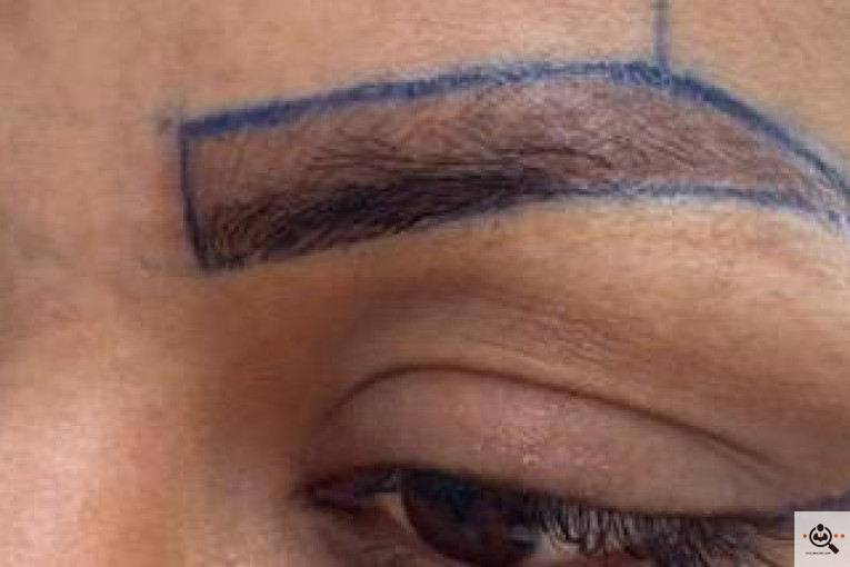 بهترین و پرتراکم ترین مرکز و روش تخصصی کاشت مو و ابرو در تهران