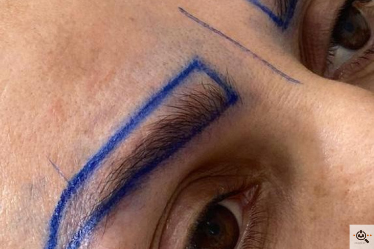 بهترین و پرتراکم ترین مرکز و روش تخصصی کاشت مو و ابرو در تهران