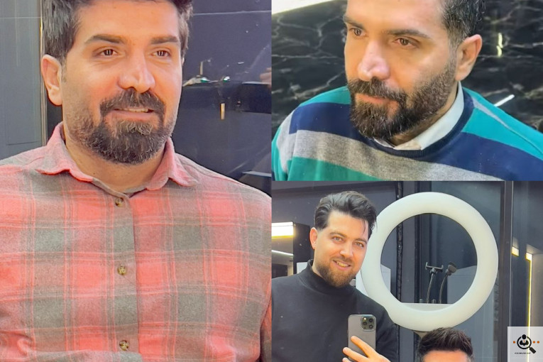 پروتز مو در سراسر ایران