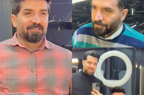 پروتز مو در سراسر ایران