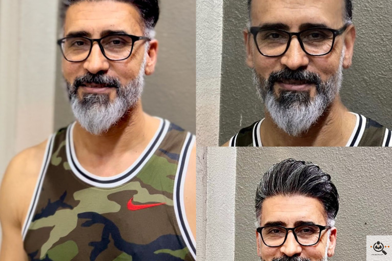 پروتز مو در سراسر ایران