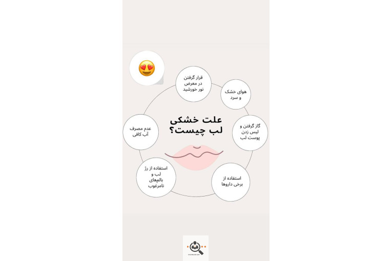 خدمات فیبروز و میکروبلیدینگ ابتسام مچری در شاهین شهر اصفهان