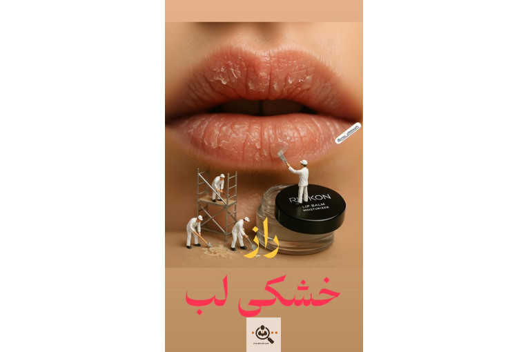 خدمات فیبروز و میکروبلیدینگ ابتسام مچری در شاهین شهر اصفهان