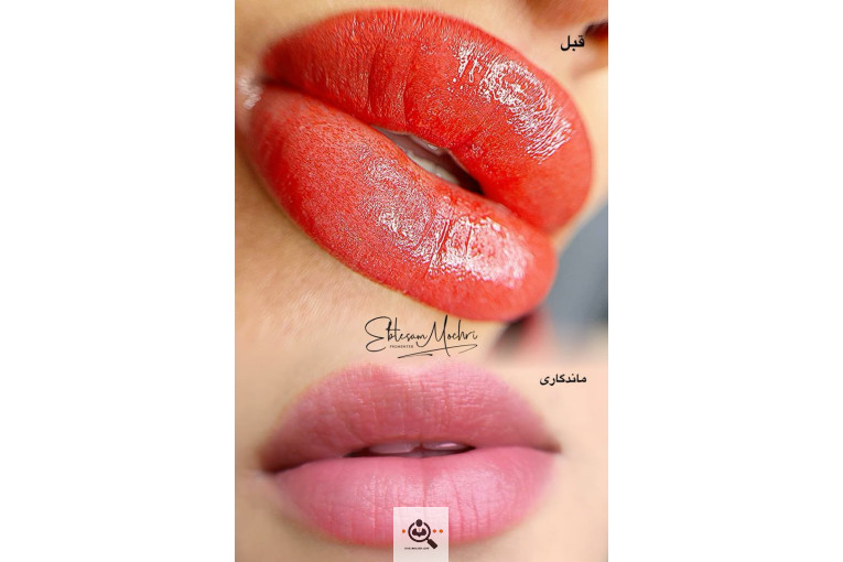 خدمات فیبروز و میکروبلیدینگ ابتسام مچری در شاهین شهر اصفهان