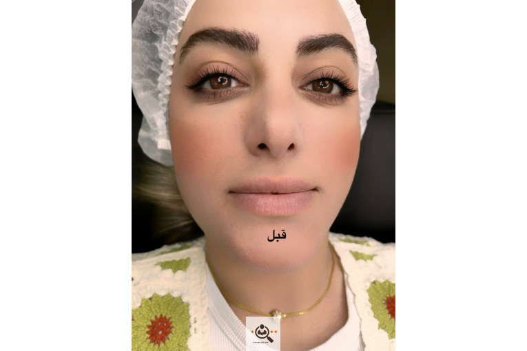 خدمات فیبروز و میکروبلیدینگ ابتسام مچری در شاهین شهر اصفهان