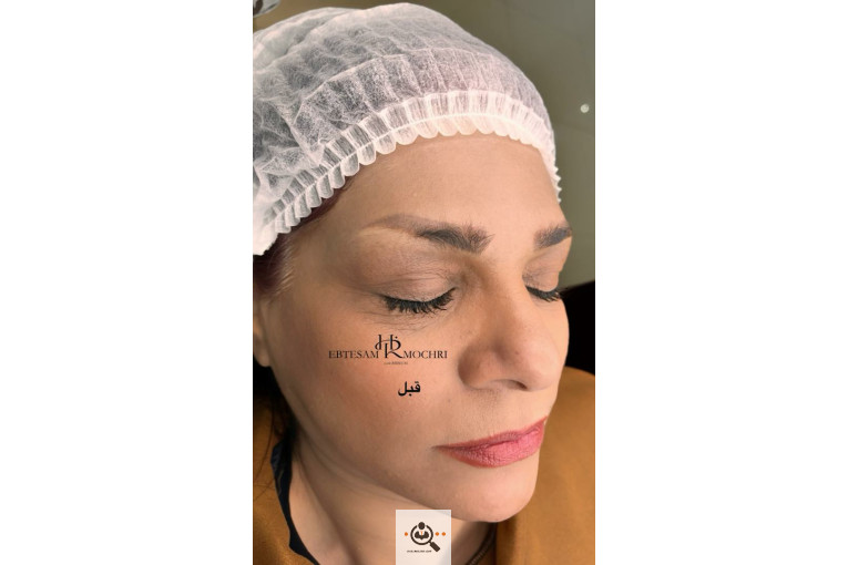 خدمات فیبروز و میکروبلیدینگ ابتسام مچری در شاهین شهر اصفهان