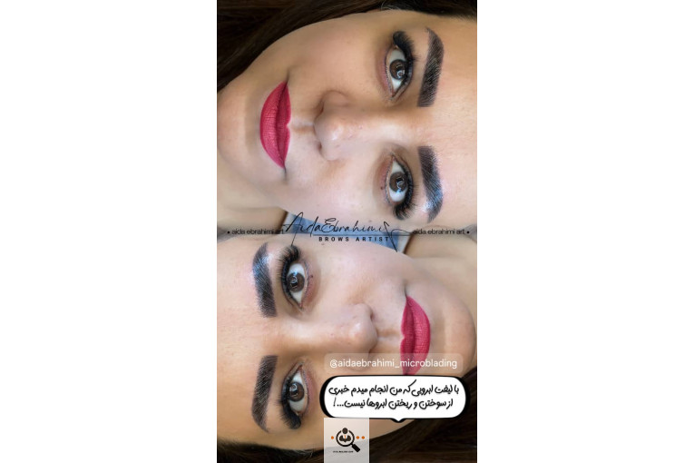 میکروبلیدینگ آیدا ابراهیمی در اصفهان