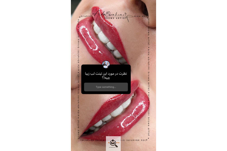 میکروبلیدینگ آیدا ابراهیمی در اصفهان