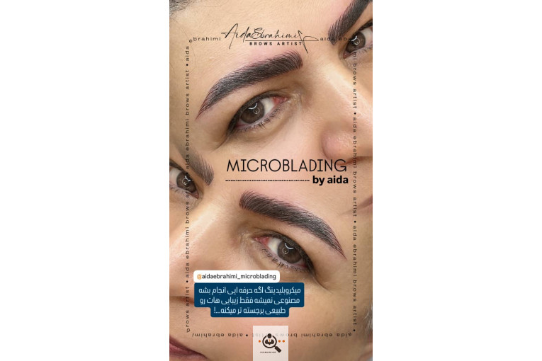 میکروبلیدینگ آیدا ابراهیمی در اصفهان