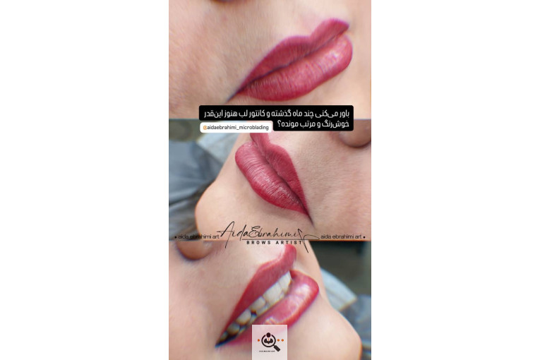 میکروبلیدینگ آیدا ابراهیمی در اصفهان