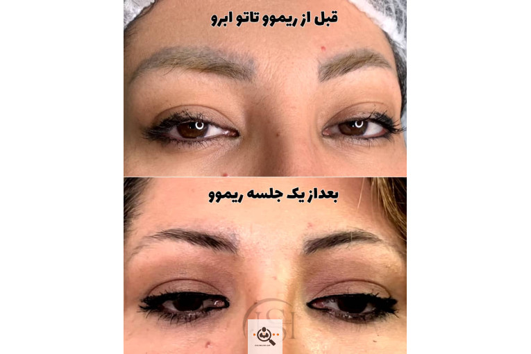 آرایش دائم شیما سلیمان نژاد در سنندج