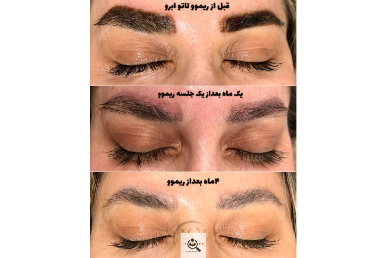 آرایش دائم شیما سلیمان نژاد در سنندج