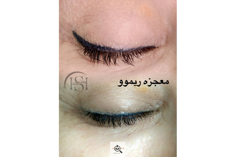 آرایش دائم شیما سلیمان نژاد در سنندج