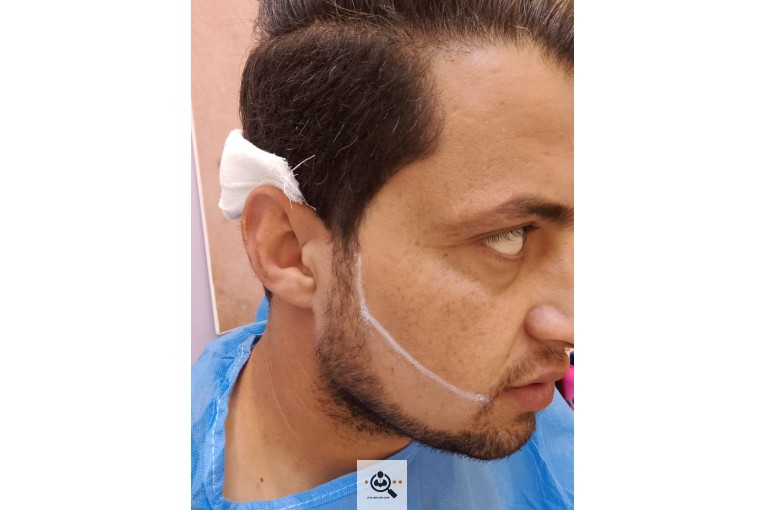 خدمات کاشت مو و ابرو مرضیه دلیان در اهواز