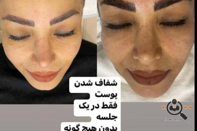 خدمات پوستی نسرین عظیمی در تهران